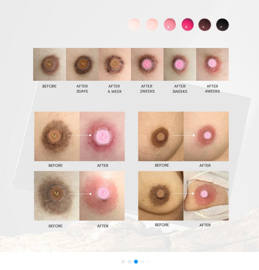 Melanin care areola