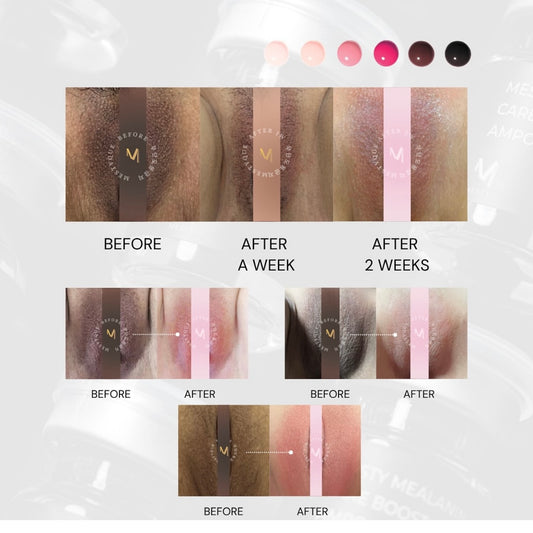 Intimate Melanin care